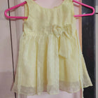 Set of 3 Frock/Dress for Baby Girl – Adorable Styles for Every Occasion! 